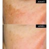Patyka Pack Anti-Flecken-Korrekturserum 30 ml + Hochschutz-Anti-Flecken-Fluid SPF 30 40 ml