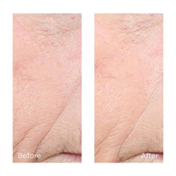 Perricone Vitamina C Éster CCC + Complexo Iluminador Ferúlico 20% 59 ml
