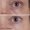 Crème éclaircissante contour des yeux Perricone Vitamine C Ester CCC + Férulique 15 ml