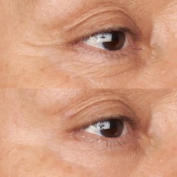 Perricone Creme para os Olhos Hipoalergênico Clean Correction Firmador e Iluminador 15 ml