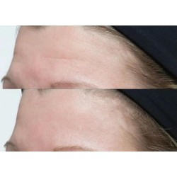 Perricone Neuropeptide Gesichtscreme 74 ml