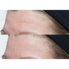 Perricone Neuropeptide Gesichtscreme 74 ml