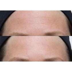 Perricone Neuropeptide Gesichtscreme 74 ml